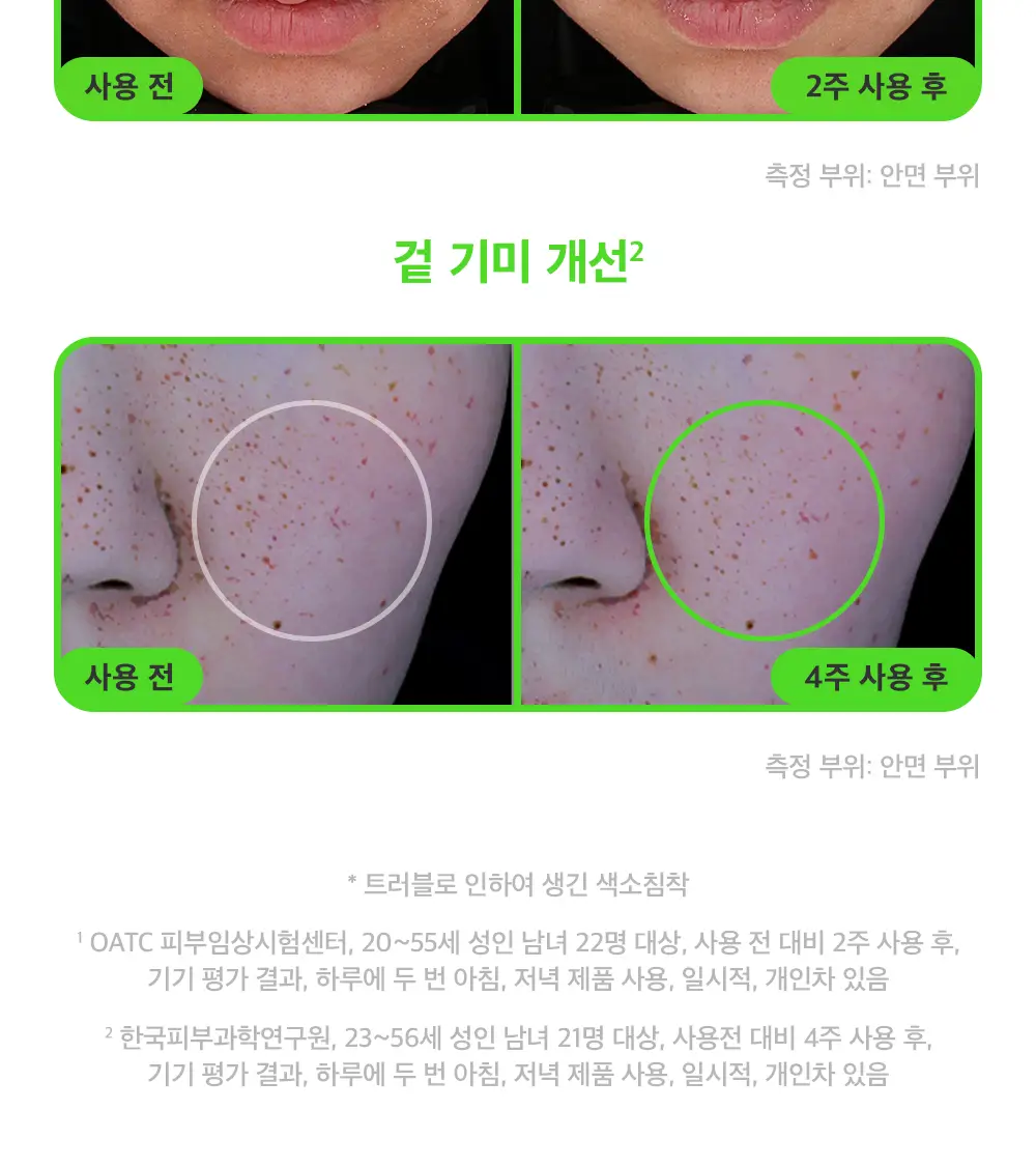 [모공컨트롤샷]폴라초이스 10% 나이아신아마이드 부스터 앰플 20ml 상세페이지 15